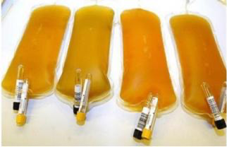 Human plasma bags — raw material for fractionation